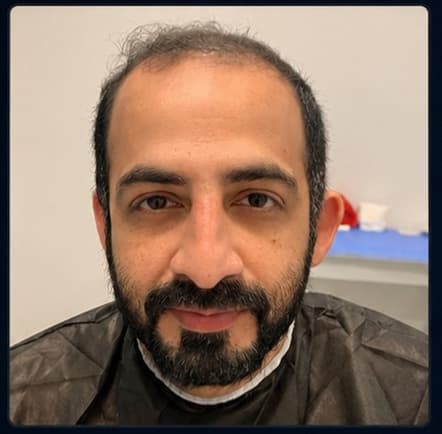 Patient photograph before the procedure